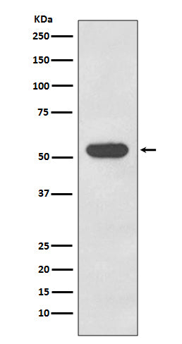 Cytokeratin 4 (11K16) Rabbit Monoclonal Antibody