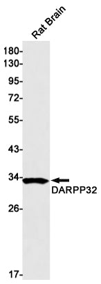 DARPP32 (18W7) Rabbit Monoclonal Antibody