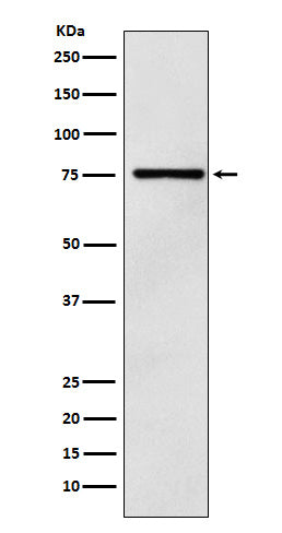 DCP1A (1Q16) Rabbit Monoclonal Antibody