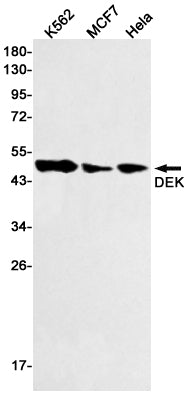 DEK (19H13) Rabbit Monoclonal Antibody