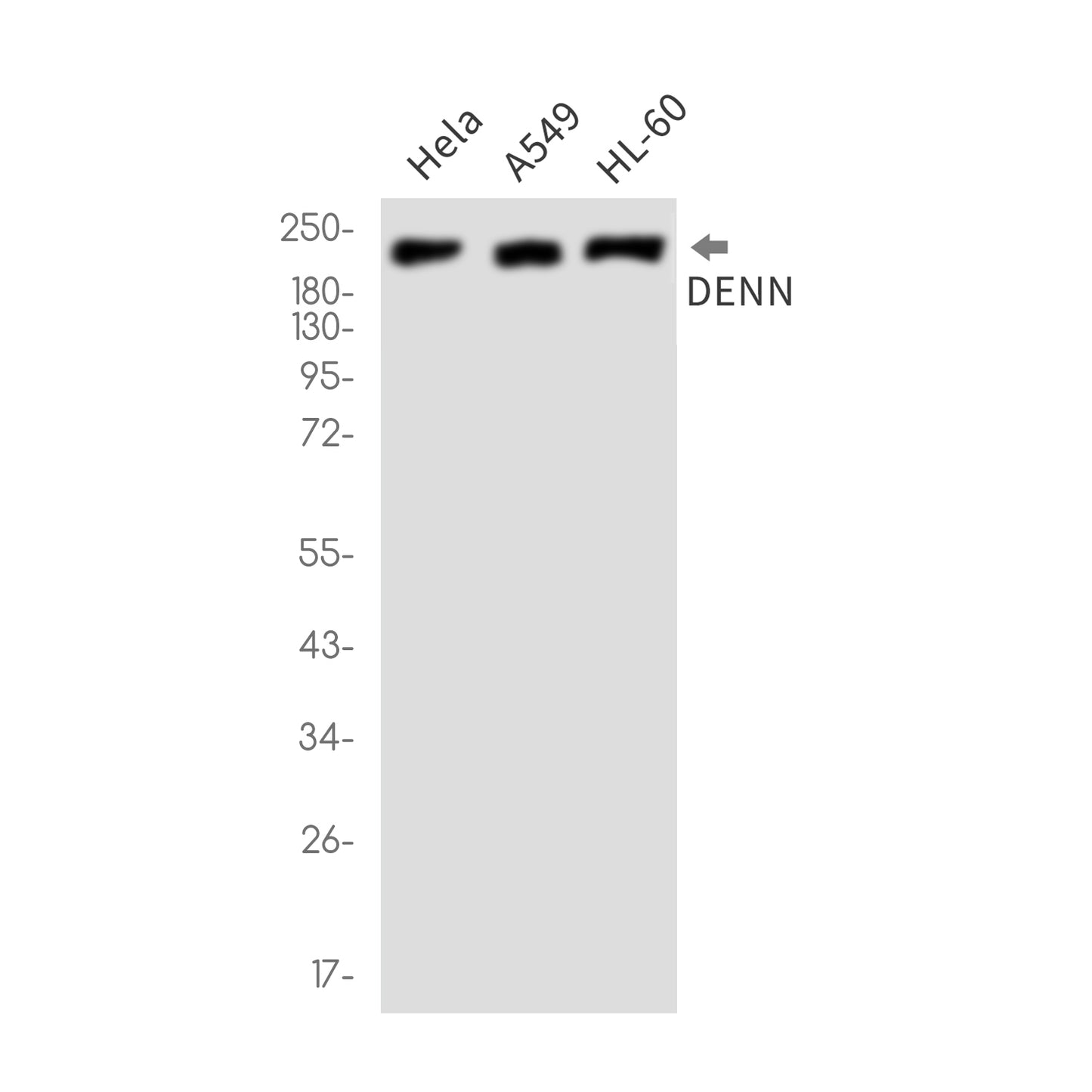 DENN (5N10) Rabbit Monoclonal Antibody