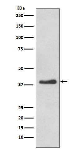 DKK1 (7G7) Rabbit Monoclonal Antibody