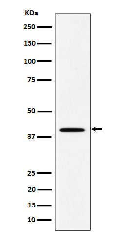 DLX3 (5D5) Rabbit Monoclonal Antibody
