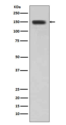 DSG1 (6U3) Rabbit Monoclonal Antibody