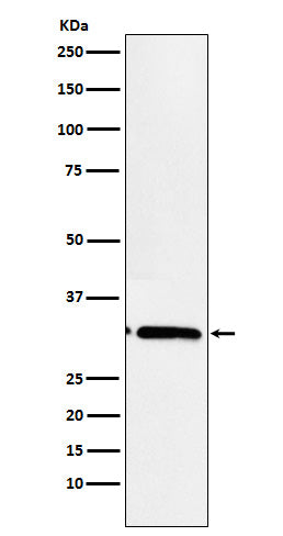 EB3 (3K10) Rabbit Monoclonal Antibody