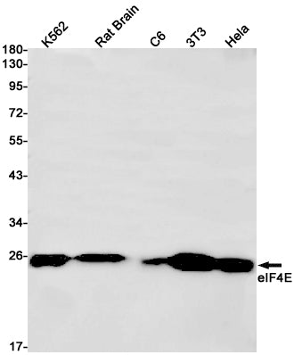 EIF4E (3K6) Rabbit Monoclonal Antibody