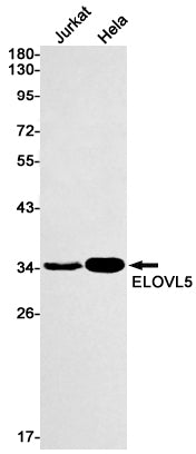 ELOVL5 (18Q15) Rabbit Monoclonal Antibody