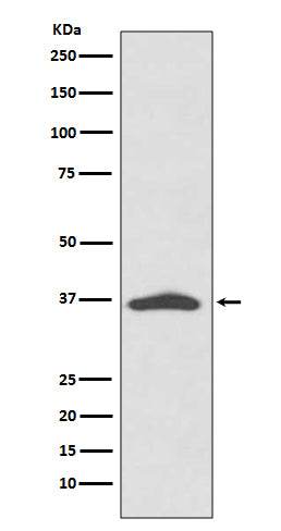 EpCAM (15A7) Rabbit Monoclonal Antibody