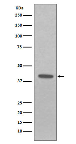EpCAM (17E13) Rabbit Monoclonal Antibody