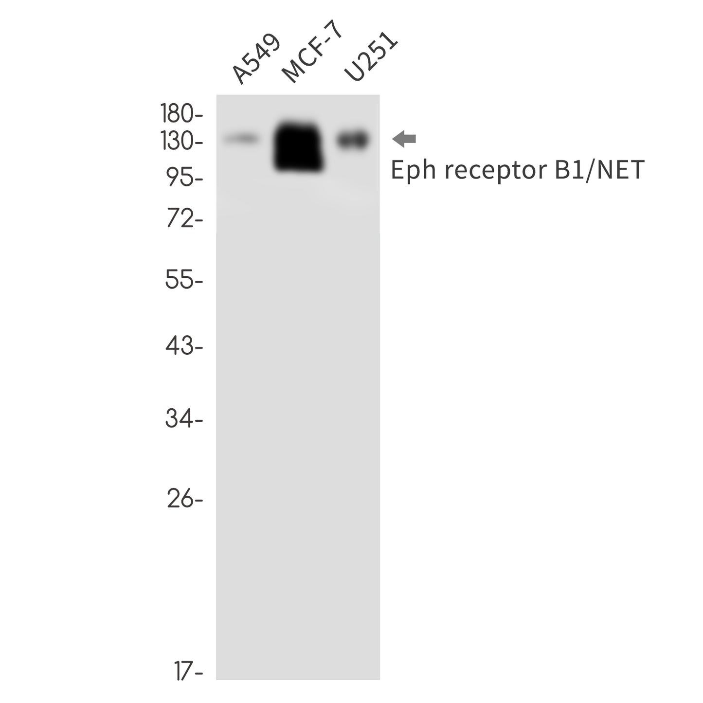 Eph receptor B1 (19N17) Rabbit Monoclonal Antibody