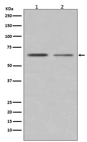 ER alpha (12J19) Rabbit Monoclonal Antibody