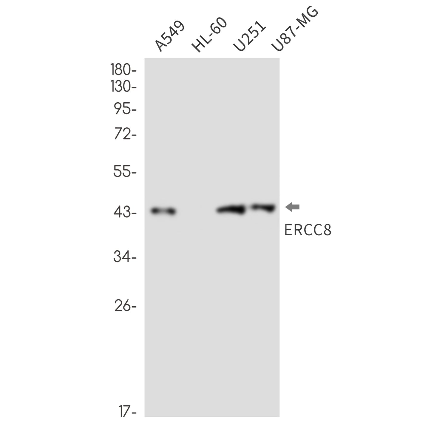 ERCC8 (3A18) Rabbit Monoclonal Antibody
