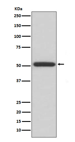 ERp57 (7K11) Rabbit Monoclonal Antibody