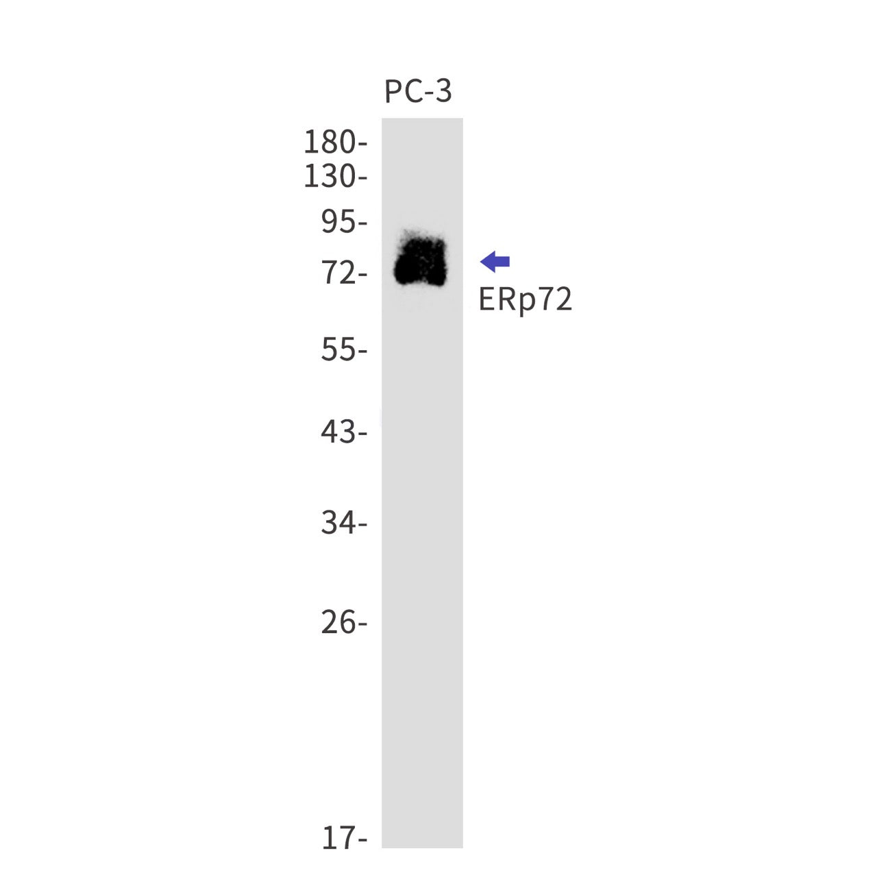 ERp72 (5U2) Rabbit Monoclonal Antibody