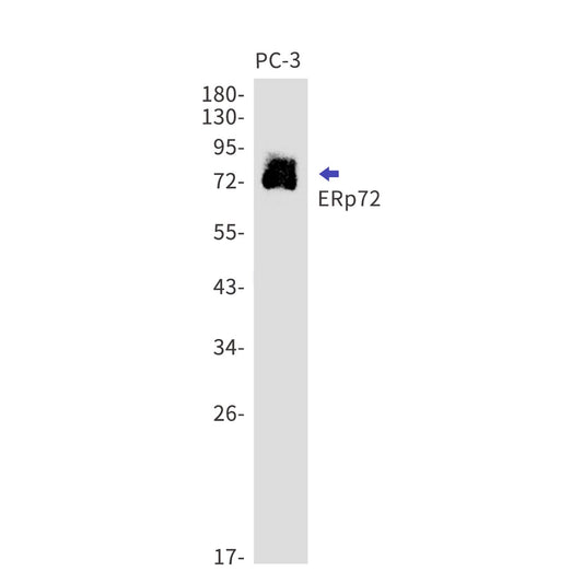 ERp72 (5U2) Rabbit Monoclonal Antibody