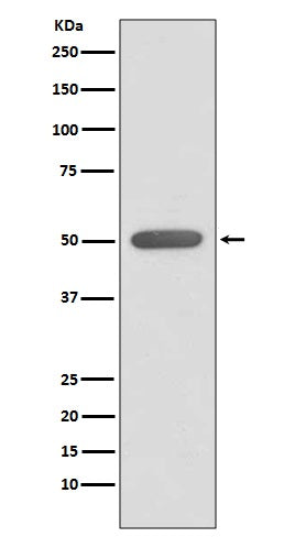ERR alpha (18W8) Rabbit Monoclonal Antibody
