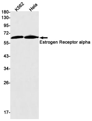 Estrogen Receptor alpha (8U16) Rabbit Monoclonal Antibody