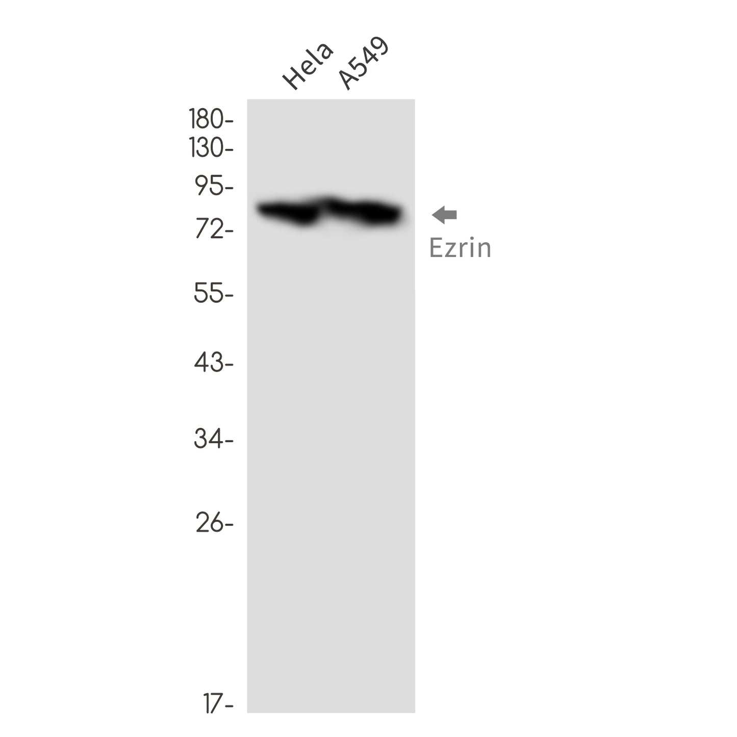 Ezrin (6V7) Rabbit Monoclonal Antibody