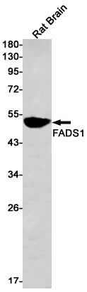 FADS1 (6Q19) Rabbit Monoclonal Antibody