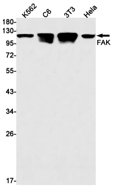 FAK (11Z9) Rabbit Monoclonal Antibody