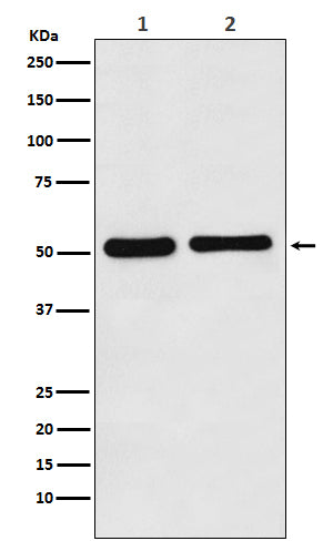 Fascin (7W3) Rabbit Monoclonal Antibody