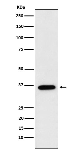 FBP1 (16B16) Rabbit Monoclonal Antibody