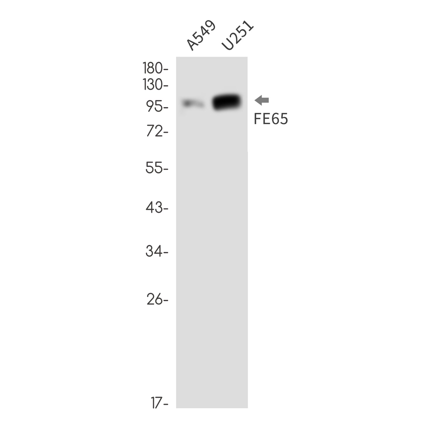 FE65 (4V18) Rabbit Monoclonal Antibody