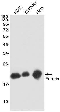 Ferritin (18K15) Rabbit Monoclonal Antibody