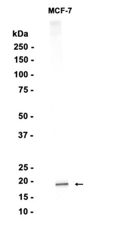 Ferritin Light Chain (10S14) Rabbit Monoclonal Antibody