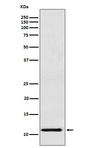 fetal hemoglobin (14V10) Rabbit Monoclonal Antibody