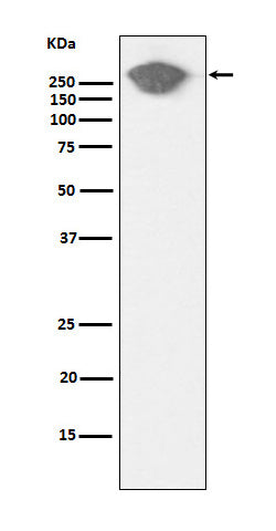 Fibronectin (12V17) Rabbit Monoclonal Antibody