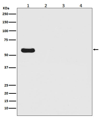 Firefly Luciferase (13Z19) Rabbit Monoclonal Antibody