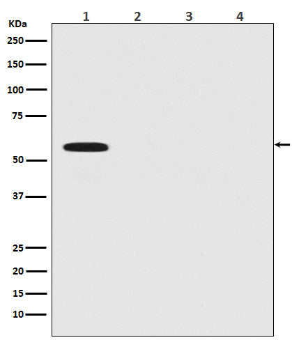 Firefly Luciferase (7T13) Rabbit Monoclonal Antibody