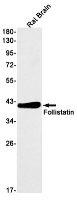 Follistatin (5U17) Rabbit Monoclonal Antibody