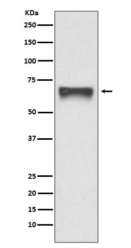 FoxO4 (5Z13) Rabbit Monoclonal Antibody