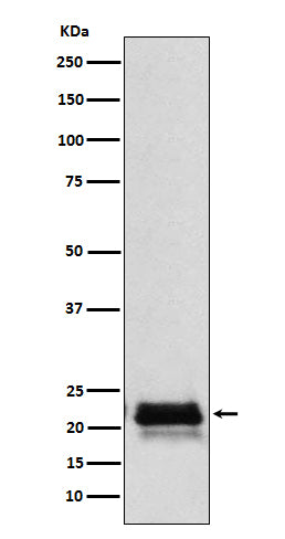 FSH beta （FSHB） (3X13) Rabbit Monoclonal Antibody