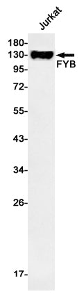 FYB (3G12) Rabbit Monoclonal Antibody