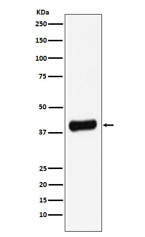Galectin 8 (14S17) Rabbit Monoclonal Antibody