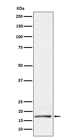 GCDFP 15 (8J14) Rabbit Monoclonal Antibody
