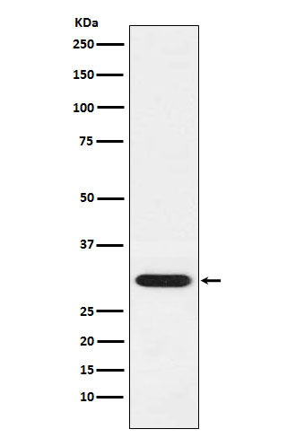 GCLM (17S11) Rabbit Monoclonal Antibody