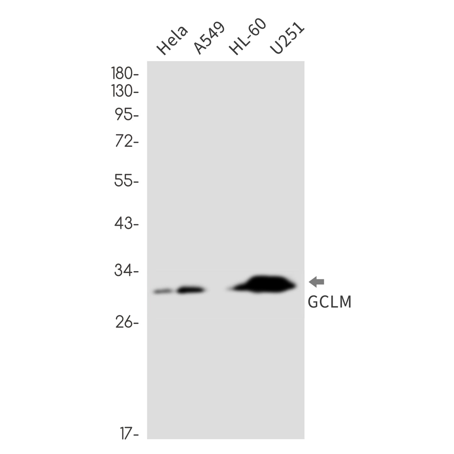 GCLM (6U5) Rabbit Monoclonal Antibody