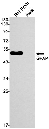 GFAP  (18L1) Rabbit Monoclonal Antibody