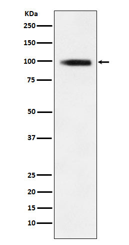 GIT1 (19X13) Rabbit Monoclonal Antibody