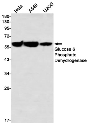 Glucose 6 Phosphate Dehydrogenase (5Y1) Rabbit Monoclonal Antibody
