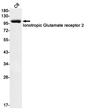GluR2 (5C16) Rabbit Monoclonal Antibody