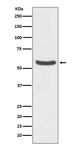 GLUT2 (6F2) Rabbit Monoclonal Antibody