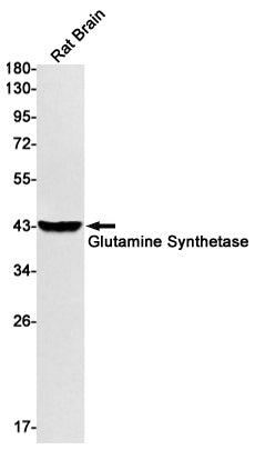 Glutamine Synthetase   (14W15) Rabbit Monoclonal Antibody