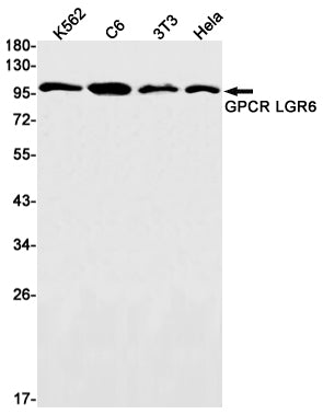 GPCR / LGR6 (5S15) Rabbit Monoclonal Antibody