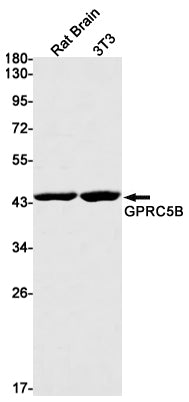 GPRC5B (12F15) Rabbit Monoclonal Antibody