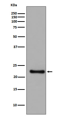 GPX1 (13J4) Rabbit Monoclonal Antibody